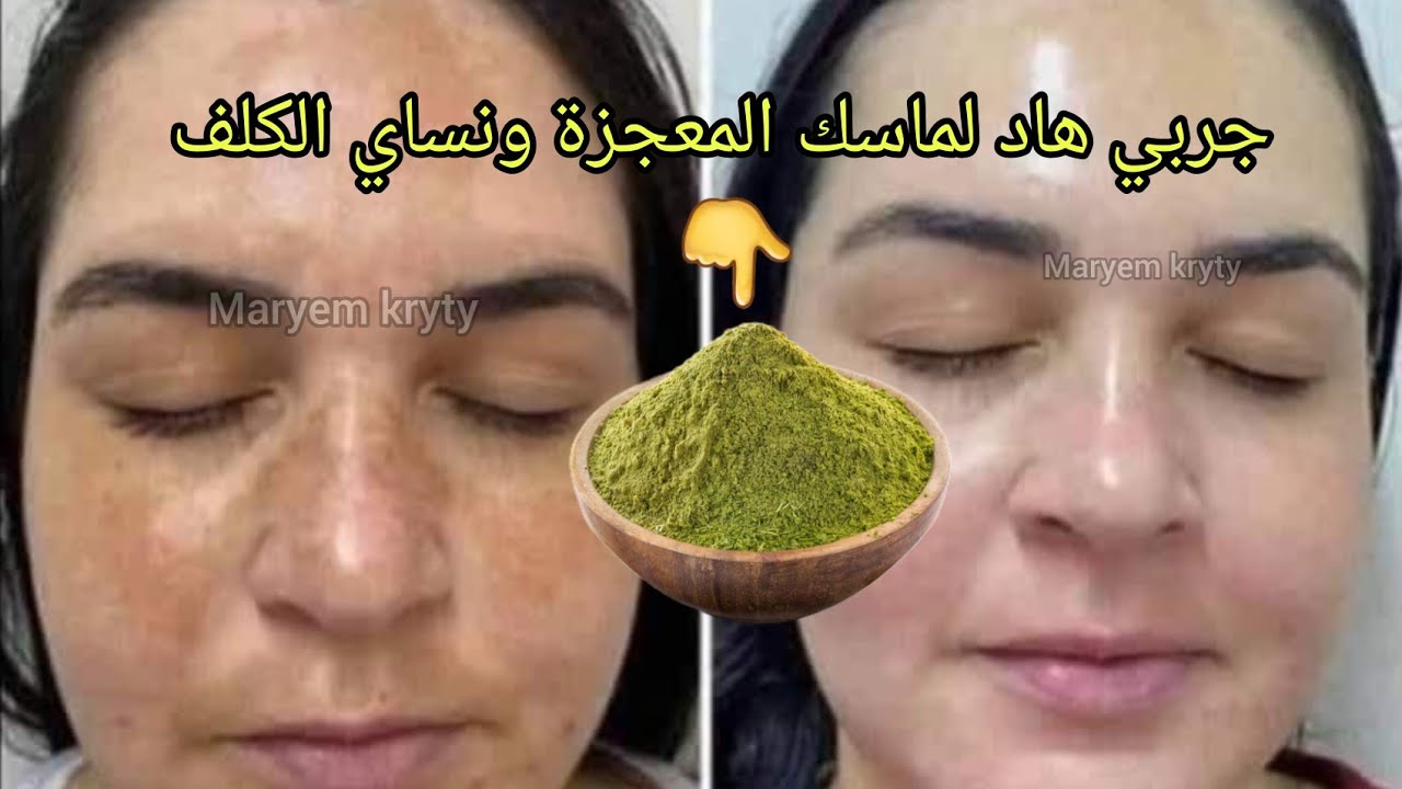 ماسك السدر المعجزة لتبيض الوجه في ربع ساعة قولي وداعا للتجاعيد والتصبغات بشرة كالثلج😍جربيه بنفسك👌