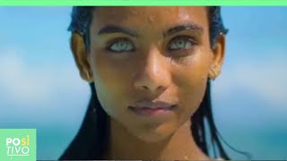 O Estranho Caso Da Jovem Com Os Olhos Mais Lindos Do Mundo