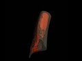 Tracking of Bone Loss Through Serial µ-CT Image Registration, 1408 view 2