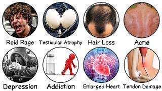 Dangerous Effects of Abusing Steroids Explained