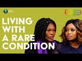 Living With A Rare Condition - Lupus | Unpacked with Relebogile Mabotja - Episode 17 | Season 2