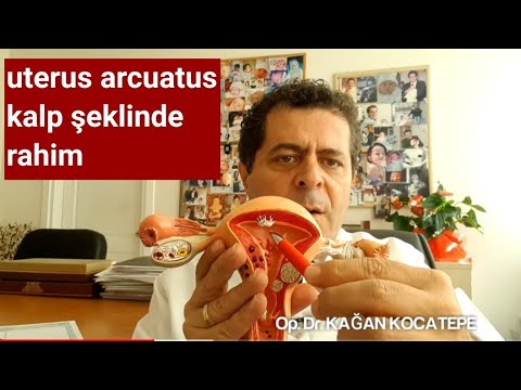 Kalp şeklinde rahim (uterus arcuatus) gebe kalamama, düşük, erken doğum yapar mı, tedavi gerekir mi?