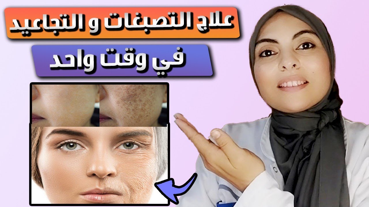 وصفة لعلاج التصبغات و الكلف و التجاعيد في آن واحد