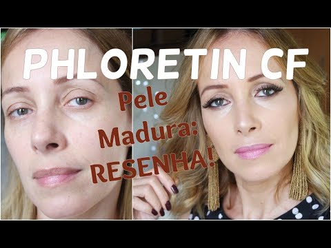 Vídeo: Posso usar floretina cf à noite?