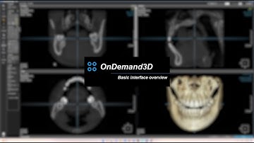 OnDemand 3D part 3