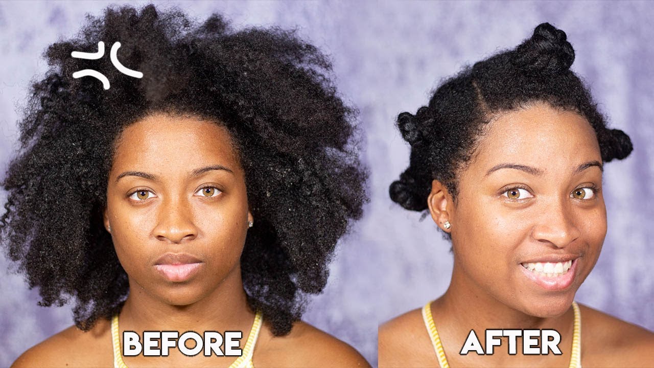 How To Cure Dry Flaky Scalp On Coarse Type 4 Hair Youtube
