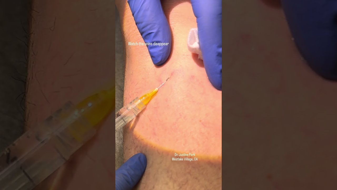 youtube-video-thumbnail