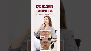 Как поднять уголки губ и убрать складки после 40