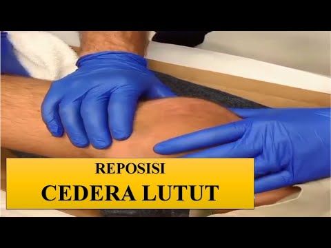 Cara Reposisi Cedera Lutut, Dislokasi Patella (tempurung Lutut)