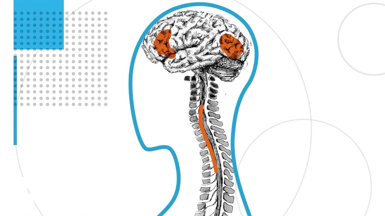 Exploring the Science of a Relapsing MS Treatment | WIRED Brand Lab, Sponsored by Biogen - Produced by WIRED Brand Lab with Biogen  | Many unknowns surround relapsing multiple sclerosis. Watch as WIRED Brand Lab looks deeper at how the condition manif
