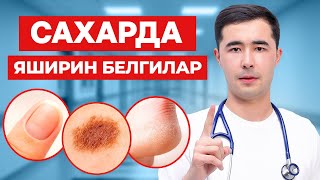 картинка: КАНДЛИ ДИАБЕТ ШУНДАЙ БОШЛАНАДИ. САХАФАРДА ЯШИРИН ИЛК БЕЛГИЛАР ВА ДАВОЛАШ