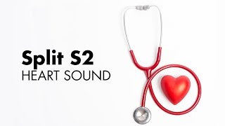 Fixed Split S2 - Heart Sounds - MEDZCOOL