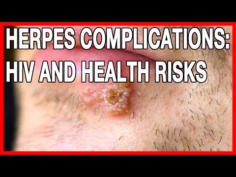 STDs: Herpes Complications, HIV And Health Risks