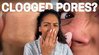 How to Get Rid of Blackheads & Whiteheads FAST (Medicube Zero Pore Review)