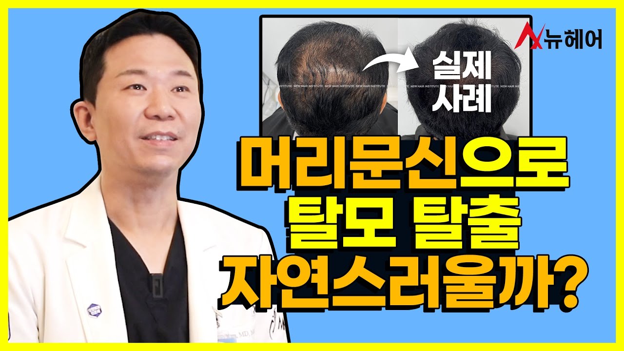 머리문신으로 탈모 벗어나자! 두피문신 실제사례 효과 증명有｜뉴헤어