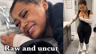 We documented Ally’s Brazilian Butt Lift recovery for 2 Weeks straight... | THE RAW UNCUT TRUTH!!! Wealth