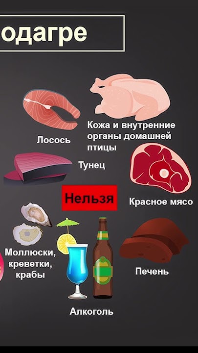 Подагра 🔥 Причины подагры у мужчин и женщин #shorts - YouTube