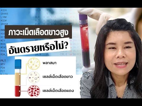 เม็ดเลือดขาวมากเกินปกติต้องทำแบบนี้ค่ะ