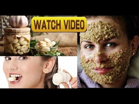 Garlic Face Mask For Acne,Blackhead,Anti-Ageing | Beauty & Health Benefits | Watch Till The End
