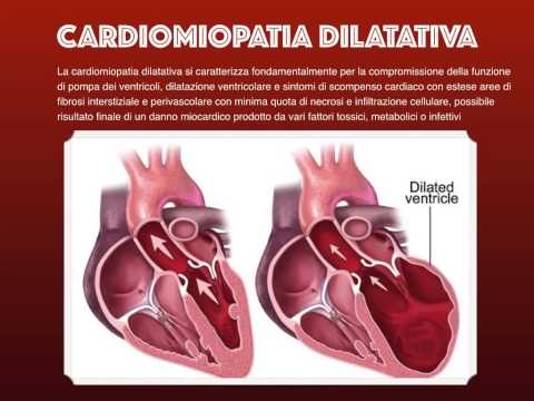 Patologie dell&rsquo;Apparato Cardiovascolare