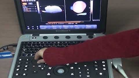 SonoBook9 4D operation training