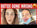Botox Gone Wrong (WATCH before getting Botox!)
