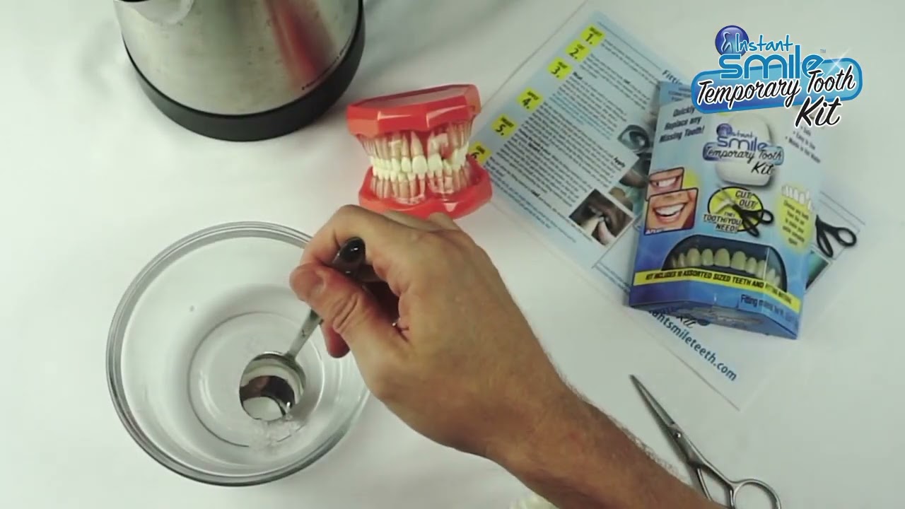Instant Smile Temporary Tooth Kit