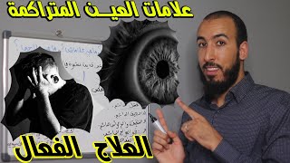 ما هي العين المتراكمة؟ وما هي علاماتها؟ وما هو برنامج علاجها والتخلص منها؟