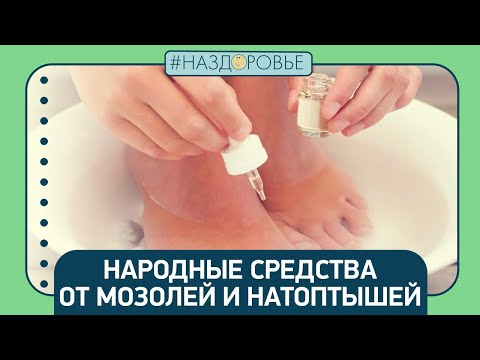 #НАЗДОРОВЬЕ: народные средства от мозолей