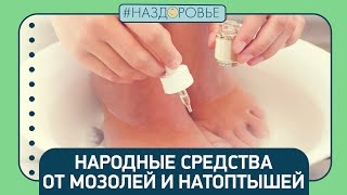 видео: #НАЗДОРОВЬЕ: народные средства от мозолей картинка: #НАЗДОРОВЬЕ: народные средства от мозолей