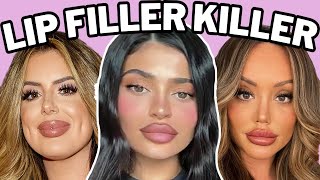 lip fillers will ruin you