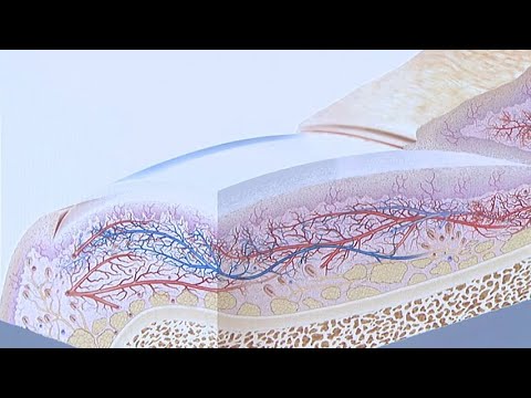 All About Health - Nail Fungus (大愛醫生館 - 甲床著色)