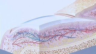 All About Health - Nail Fungus (大愛醫生館 - 甲床著色)