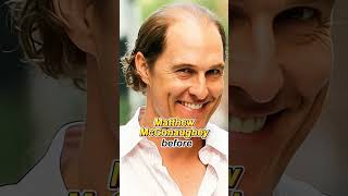 Among the 11 male celebrities who wore wigs to cover their baldness #actor #facts #hollywood