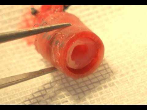 3D-printed Blood Vessel Working Well in Monkey Trial