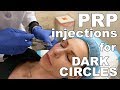 PRP (Platelet Rich Plasma) Eye Rejuvenation - Lori Ward, CRNP | West End Plastic Surgery