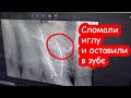 VLOG Оставили иголку в зубе. Костя хочет подать в суд