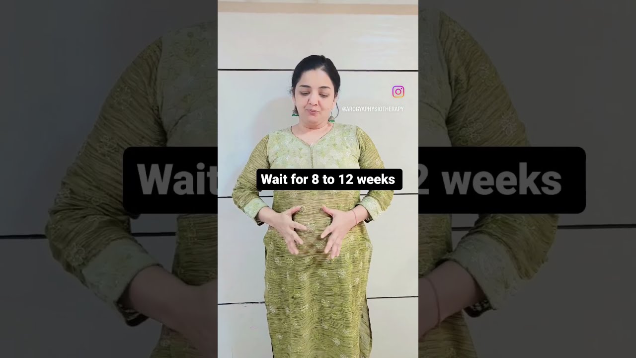 When Should You Start Exercising After A C Section Surgery Arogya Physio Tips Workout