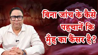 मुंह का कैंसर (Oral Cancer) के लक्षण और बचाव | कैंसर स्पेशलिस्ट डॉ. हर्षवर्धन screenshot 2