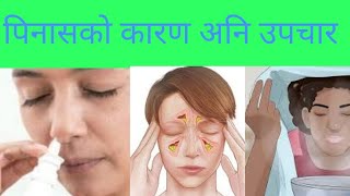 Sinusitis in Nepali |पिनासको उपचार कसरी|Dr Deepak Poudel|doctor sathi