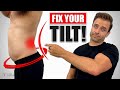 Fix Your TILT! How To Correct Bad Lower Back Posture For Good!