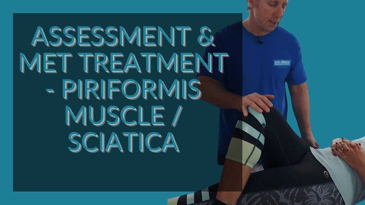 Assessment & Treatment of the Piriformis Muscle / Sciatica YouTube