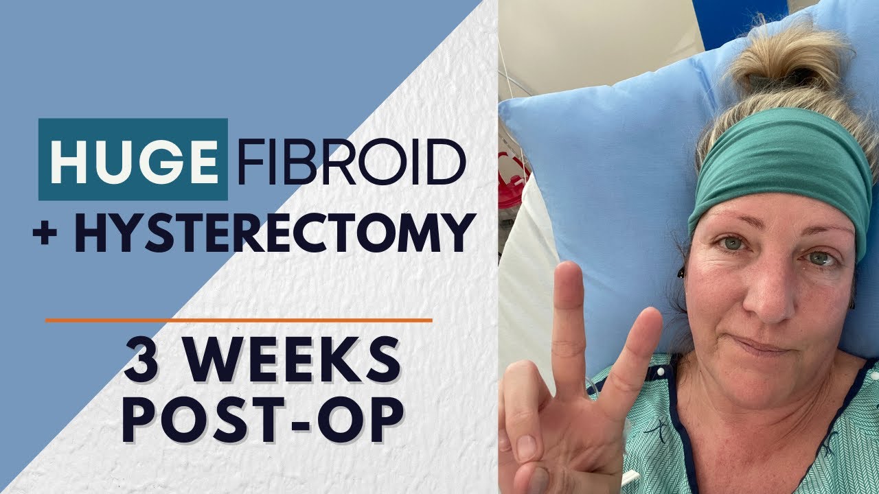 Total Abdominal Hysterectomy + Huge Fibroid Removal +  - My Story (Part 1)