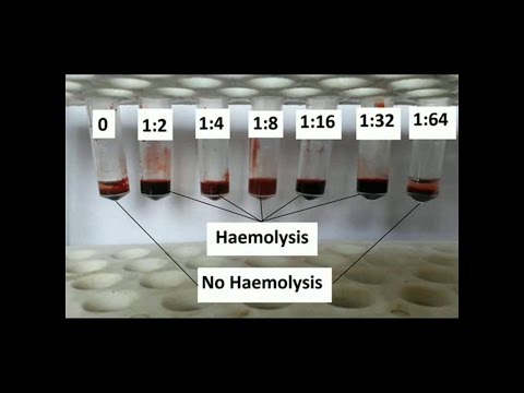 How to Determine antibody titer