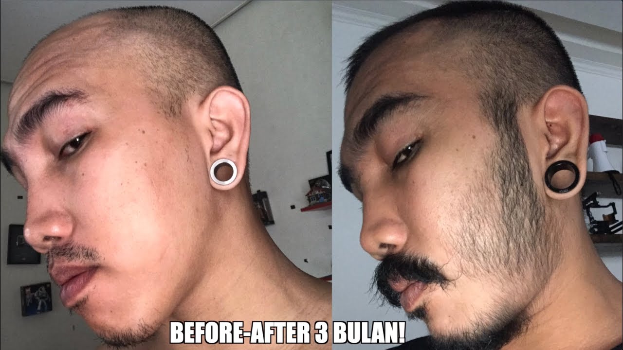 Cara Menumbuhkan Brewok Permanen Tanpa Bakat Brewok - YouTube