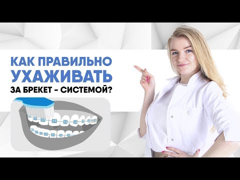 Как правильно ухаживать за брекетами?