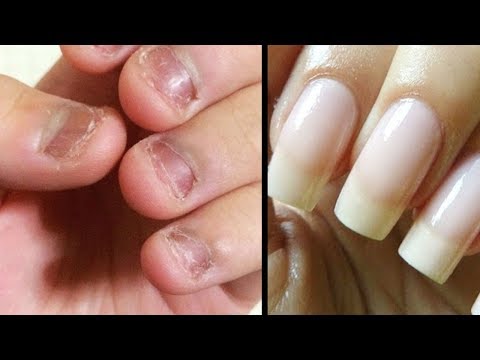 Video: Tipps, Um Ihre Nägel Im Sommer Perfekt Zu Pflegen