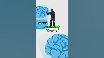 Revolutionizing Healthcare with Brain Computer Interfaces