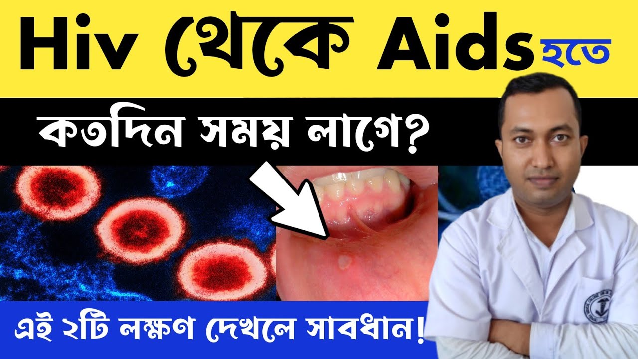 Hiv থেকে Aids হতে কতদিন লাগবে ? Hiv সংক্রমনের প্রধান 2টি লক্ষণ Hiv Or