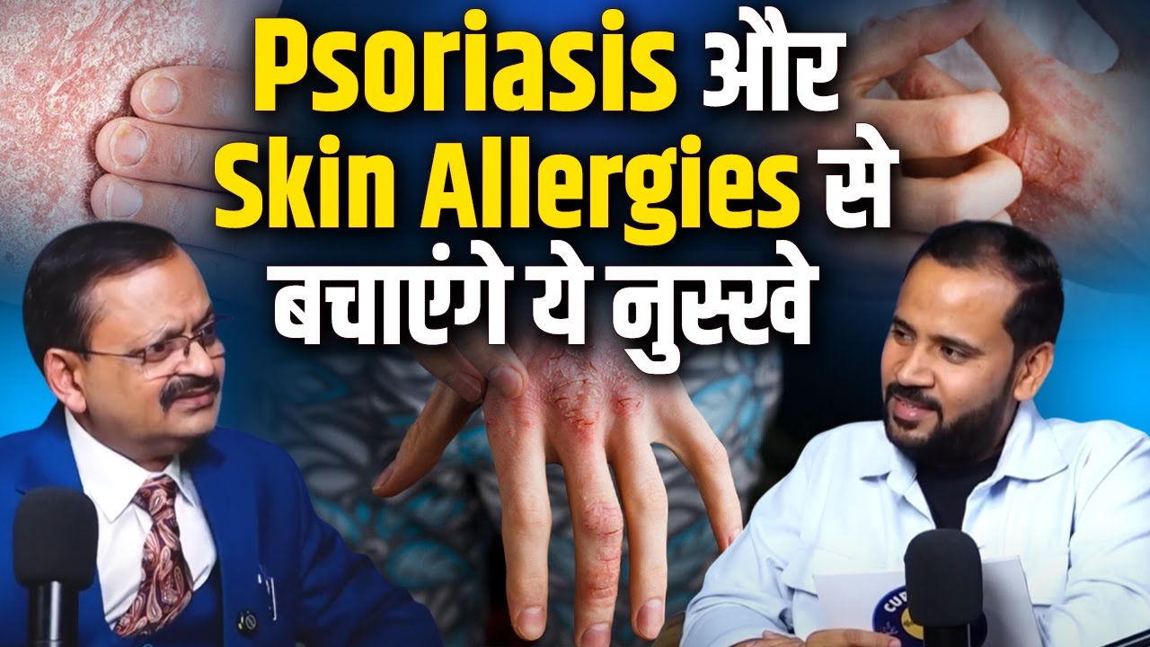 Impact Feature- Psoriasis और Skin Allergies से बचेंगे ये नुस्खे | Subhash Goyal & RJ Kartik